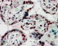 PAB6884 - CBX1