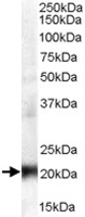 PAB6885 - CBX3