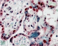 PAB6885 - CBX3