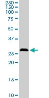 PAB6891 - SIRT3