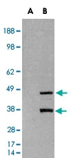 PAB6891 - SIRT3