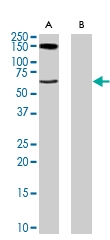 PAB6899 - Amine Oxidase B / MAOB