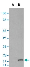 PAB6912 - RPS19