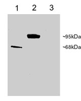 PAB6924 - PDE4D