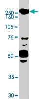 PAB6930 - ROBO1