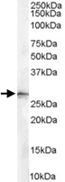 PAB6932 - 14-3-3 protein sigma / SFN