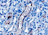 PAB6937 - VPS25