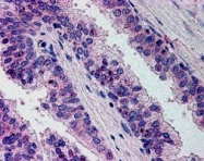 PAB6943 - ERG