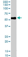 PAB6955 - CD14