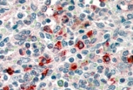 PAB6955 - CD14