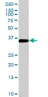 PAB6962 - TIMD3 / HAVCR2