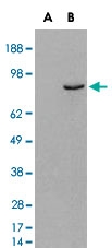 PAB6965 - PDE4B