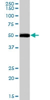 PAB6971 - DDX6