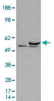 PAB6971 - DDX6