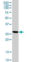 PAB6973 - CDKN1B / KIP1