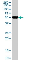 PAB6978 - ALDH1
