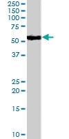 PAB7003 - SMAD9