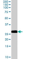 PAB7006 - PGRMC1