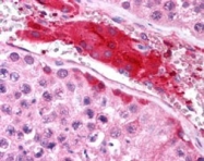 PAB7009 - HGS / HRS