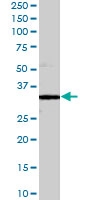 PAB7011 - Syntaxin 6 / STX6