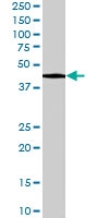 PAB7013 - 3-beta-HSD1 / HSD3B1