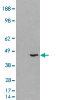 PAB7013 - 3-beta-HSD1 / HSD3B1