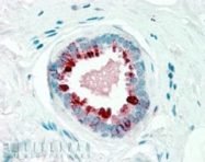 PAB7018 - PIP / GCDFP15
