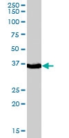 PAB7023 - AKR1C4