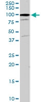 PAB7024 - Catenin alpha-1 / CTNNA1