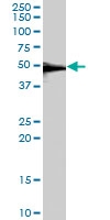 PAB7035 - Serotonin receptor 1B (HTR1B)