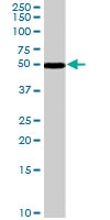 PAB7042 - Chromogranin A