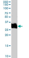 PAB7046 - Fos-related antigen 1