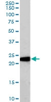 PAB7049 - Glutathione peroxidase 1 / GPX1