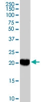 PAB7050 - Peroxiredoxin-2 / PRDX2