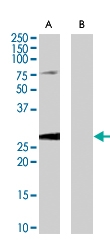 PAB7053 - EBAG9 / RCAS1