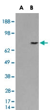 PAB7056 - Melanoma gp100