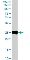 PAB7057 - CD230 / PrP