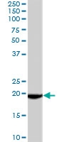 PAB7065 - Glutathione peroxidase 4 / GPX4