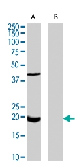 PAB7067 - Glutathione peroxidase 7 / GPX7