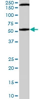 PAB7069 - Serotonin receptor 3A (HTR3A)