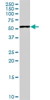 PAB7070 - WT1 / Wilms tumor protein
