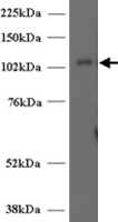 PAB7073 - UNC13D