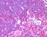 PAB7073 - UNC13D