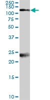 PAB7074 - NMDA Receptor 1