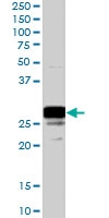 PAB7078 - COMT