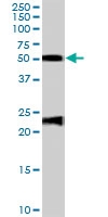 PAB7098 - Fibulin-5