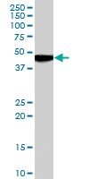PAB7100 - Muscarinic acetylcholine receptor M1