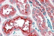 PAB7110 - CPT1A / CPT1-L