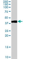 PAB7122 - Type-1 angiotensin II receptor (AT1)