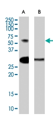 PAB7123 - TCFL5